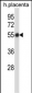 SMARCB1 Antibody (N-term)